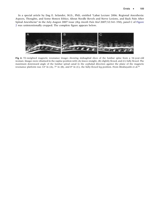 PDF extract preview