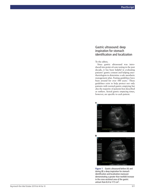 PDF extract preview