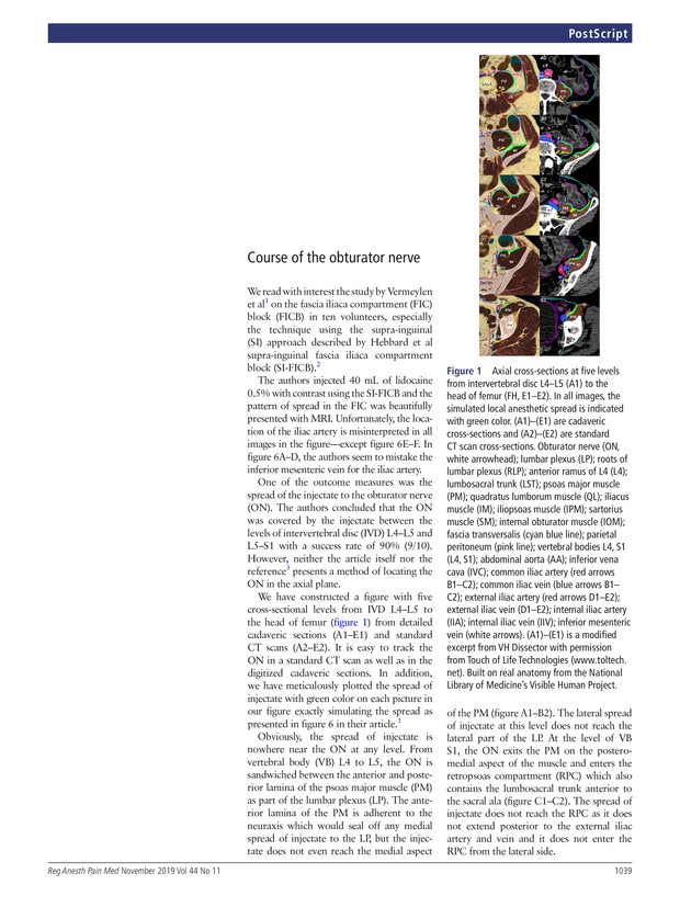 PDF extract preview