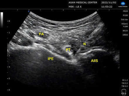 Abstract EP123 Figure 2