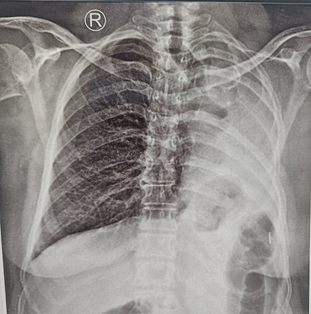 Abstract P213 Figure 1
